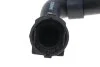 Патрубок FEBI BILSTEIN 34983 (фото 2)