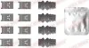 Монтажный компл.,тормоз.колодки QUICK BRAKE 1090110 (фото 1)