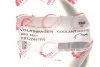 Патрубок системи охолодження Audi A3/Skoda Octavia/VW Golf V 1.9 TDI 03-10 (к-кт в зборі) ROTWEISS RWS3841 (фото 2)