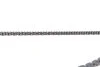 Комплект механізму натяжіння SKF VKML840041 (фото 20)
